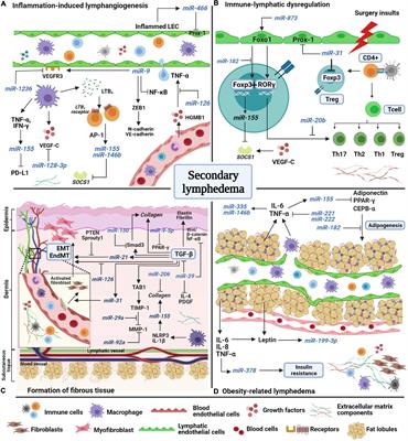 Crosstalk Between microRNAs and the Pathological Features of Secondary Lymphedema